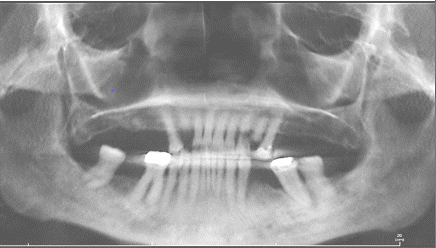 Picture1 https://amazingdentalbaja.com/wp-content/uploads/2025/08/Picture1.png